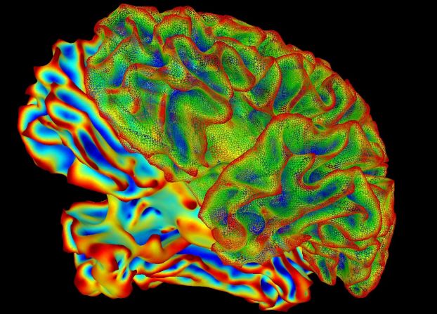 A colorful MRI image of the human brain